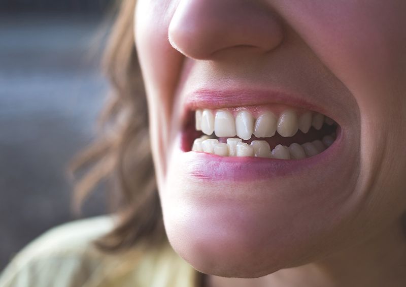 Hilfe, meine Zähne sind schief!