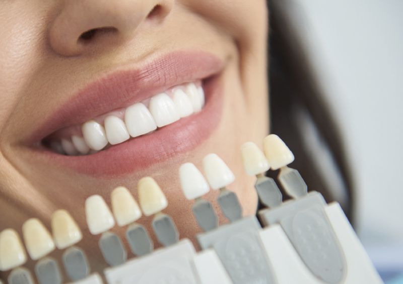 Strahlende Natürlichkeit                                 