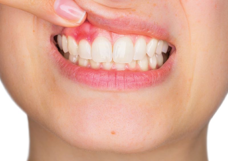 Gesundheit – Gerade Zähne – nicht nur schön, sondern gesund!