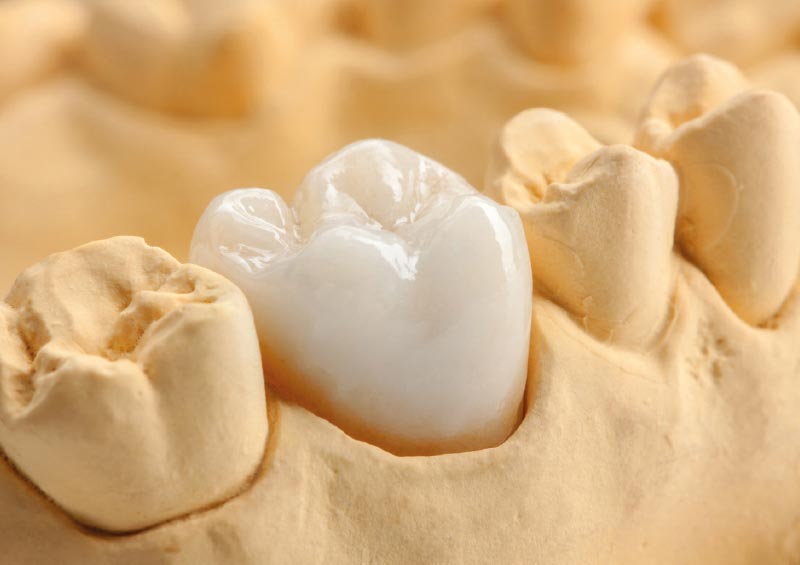 Jeder Mensch beißt anders …