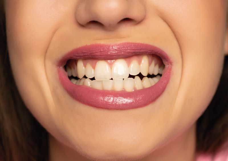 Zähneknirschen als Risikofaktor